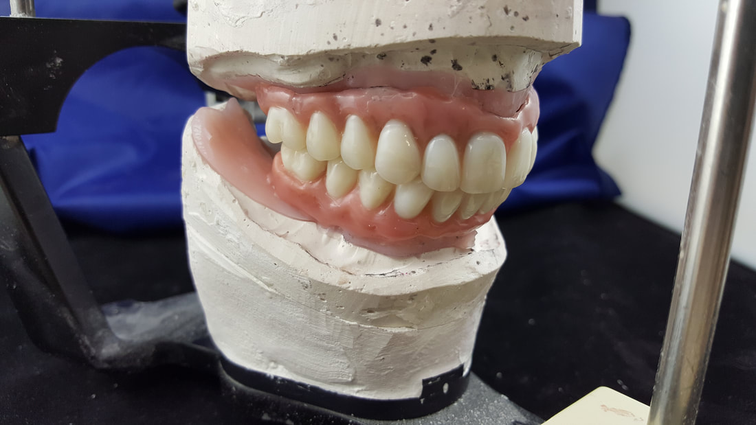 Fixed Detachable Dentures MacLarty Dental Laboratory